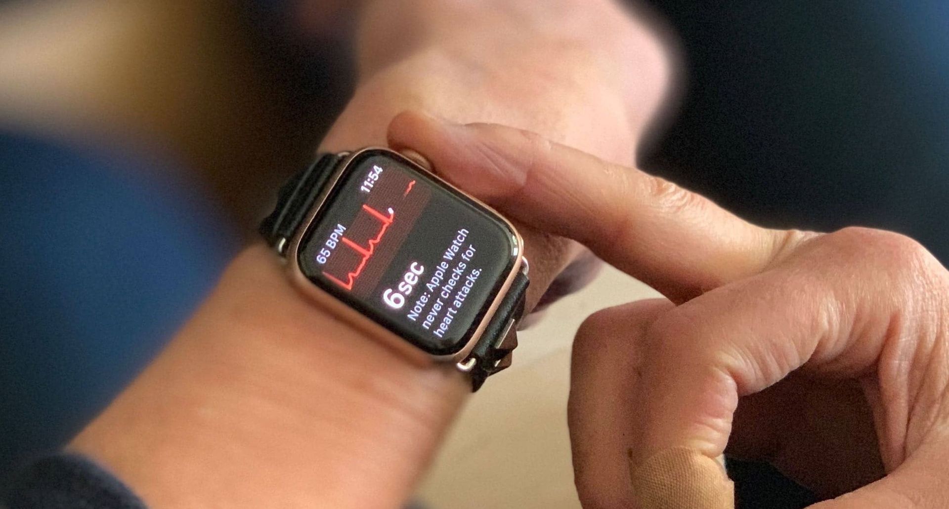 Hướng dẫn sử dụng tính năng đo điện tâm đồ ECG trên Apple Watch 3