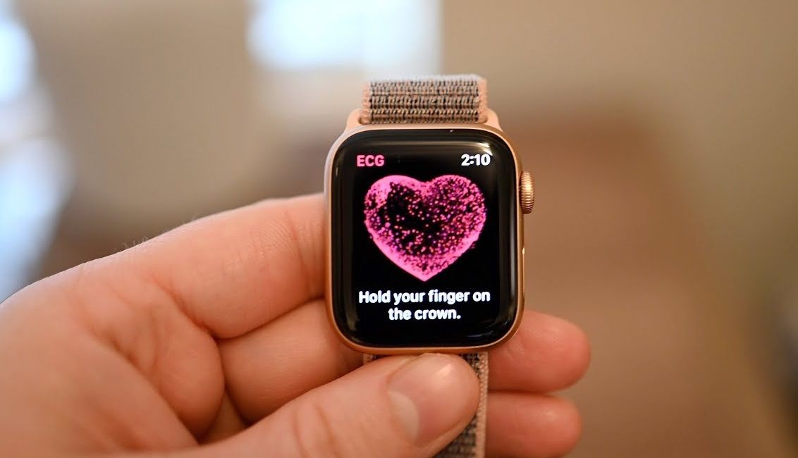 Hướng dẫn sử dụng tính năng đo điện tâm đồ ECG trên Apple Watch 5